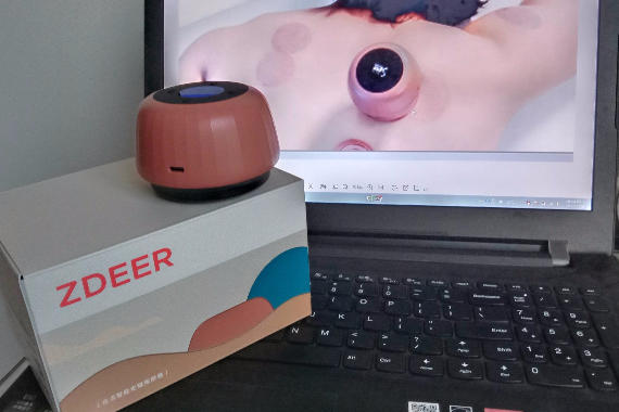 ߹ְĦͥС ߹ްĦ